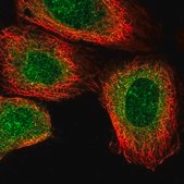 Anti-NANP antibody produced in rabbit Prestige Antibodies&#174; Powered by Atlas Antibodies, affinity isolated antibody, buffered aqueous glycerol solution