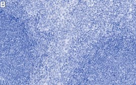 Anti-MZB1 Antibody, clone 1J15 ZooMAb&#174; Rabbit Monoclonal recombinant, expressed in HEK 293 cells