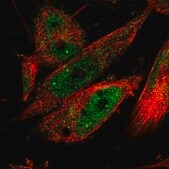Anti-CPSF2 antibody produced in rabbit Prestige Antibodies&#174; Powered by Atlas Antibodies, affinity isolated antibody, buffered aqueous glycerol solution