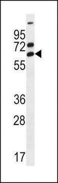 ANTI-ZNF835(N-TERMINAL) antibody produced in rabbit affinity isolated antibody, buffered aqueous solution