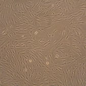 Human Fibroblast-Like Synoviocytes: HFLS, adult
