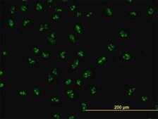 Monoclonal Anti-UBTF antibody produced in mouse clone 6B6, purified immunoglobulin, buffered aqueous solution