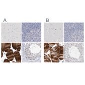 Anti-MYOT antibody produced in rabbit Prestige Antibodies&#174; Powered by Atlas Antibodies, affinity isolated antibody, buffered aqueous glycerol solution