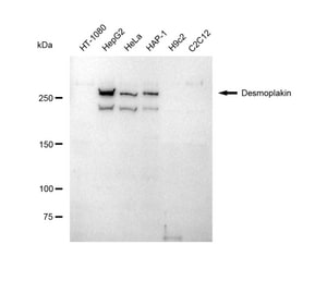 KD-Validated Anti Desmoplakin Antibody, clone 23GB5220, Rabbit Monoclonal clone 23GB5220, recombinant rabbit monoclonal, expressed in HEK293 cells