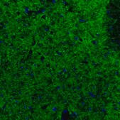 Monoclonal Anti-GAD2 antibody produced in mouse Prestige Antibodies&#174; Powered by Atlas Antibodies, clone CL2736, purified immunoglobulin, buffered aqueous glycerol solution