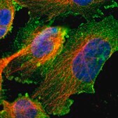 Anti-CDH4 antibody produced in rabbit Prestige Antibodies® Powered by Atlas Antibodies, affinity isolated antibody, buffered aqueous glycerol solution