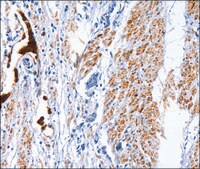 Anti-CATSPER1 antibody produced in rabbit affinity isolated antibody