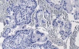 Anti-eNOS Antibody, clone 2F12 ZooMAb® Rabbit Monoclonal recombinant, expressed in HEK 293 cells