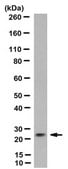 Anti-CTHRC1 Antibody, clone Vli-55 clone Vli-55, from rabbit