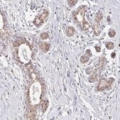 Anti-EHF antibody produced in rabbit Prestige Antibodies&#174; Powered by Atlas Antibodies, affinity isolated antibody, buffered aqueous glycerol solution