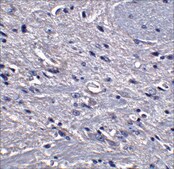 Anti-GPAT1 antibody produced in rabbit affinity isolated antibody, buffered aqueous solution