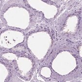Anti-TP53TG5 antibody produced in rabbit Prestige Antibodies&#174; Powered by Atlas Antibodies, affinity isolated antibody, buffered aqueous glycerol solution