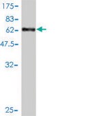 Monoclonal Anti-MAGEA2 antibody produced in mouse clone 1H4, purified immunoglobulin, buffered aqueous solution