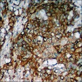 Anti-phospho-eEF2 (pThr56) antibody produced in rabbit affinity isolated antibody