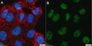 Anti-Nibrin/NBS1 Antibody, clone 3L23 ZooMAb® Rabbit Monoclonal recombinant, expressed in HEK 293 cells