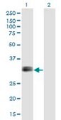 Monoclonal Anti-IGFBP1 antibody produced in mouse clone 2F9, purified immunoglobulin, buffered aqueous solution