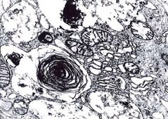 戊二醛 溶液 for electron microscopy, acc. to P.J. Anderson (purified and filled under nitrogen)