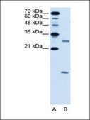 Anti-LOC203547 antibody produced in rabbit IgG fraction of antiserum