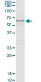 Monoclonal Anti-CTNS antibody produced in mouse clone 5G6, purified immunoglobulin, buffered aqueous solution