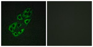 Anti-MTSSB antibody produced in rabbit affinity isolated antibody