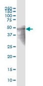 ANTI-ZNF772 antibody produced in mouse purified immunoglobulin, buffered aqueous solution