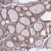 Anti-PDE8B antibody produced in rabbit Prestige Antibodies&#174; Powered by Atlas Antibodies, affinity isolated antibody, buffered aqueous glycerol solution