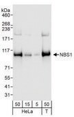 Rabbit anti-NBS1 Antibody, Affinity Purified Powered by Bethyl Laboratories, Inc.