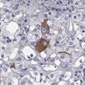 Anti-MC2R antibody produced in rabbit Prestige Antibodies&#174; Powered by Atlas Antibodies, affinity isolated antibody, buffered aqueous glycerol solution