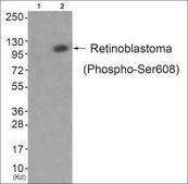 Anti-phospho-Retinoblastoma (pSer608) antibody produced in rabbit affinity isolated antibody