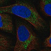 Anti-MITD1 antibody produced in rabbit Prestige Antibodies&#174; Powered by Atlas Antibodies, affinity isolated antibody, buffered aqueous glycerol solution