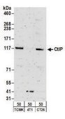 Rabbit anti-CtIP Antibody, Affinity Purified Powered by Bethyl Laboratories, Inc.