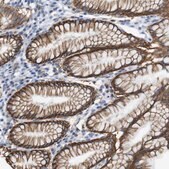 抗-ERVMER34-1 兔抗 Prestige Antibodies&#174; Powered by Atlas Antibodies, affinity isolated antibody, buffered aqueous glycerol solution