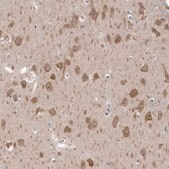 Anti-GSK3B antibody produced in rabbit affinity isolated antibody, buffered aqueous glycerol solution