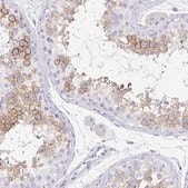 Anti-TPTE antibody produced in rabbit Prestige Antibodies&#174; Powered by Atlas Antibodies, affinity isolated antibody, buffered aqueous glycerol solution