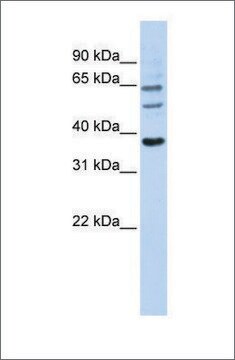 Anti-UGT1A9 antibody produced in rabbit affinity isolated antibody