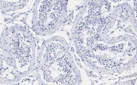 Anti-MGMT Antibody, clone 2N19 ZooMAb® Rabbit Monoclonal recombinant, expressed in HEK 293 cells