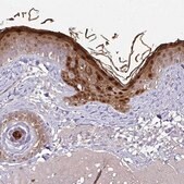 Anti-CASP14 antibody produced in rabbit Prestige Antibodies&#174; Powered by Atlas Antibodies, affinity isolated antibody, buffered aqueous glycerol solution