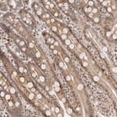 Anti-RNF146 antibody produced in rabbit Prestige Antibodies® Powered by Atlas Antibodies, affinity isolated antibody, buffered aqueous glycerol solution, ab2
