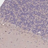 Anti-NOG antibody produced in rabbit Prestige Antibodies&#174; Powered by Atlas Antibodies, affinity isolated antibody, buffered aqueous glycerol solution