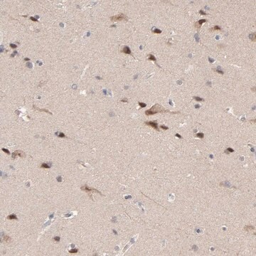 Anti-FAM199X antibody produced in rabbit Prestige Antibodies&#174; Powered by Atlas Antibodies, affinity isolated antibody, buffered aqueous glycerol solution