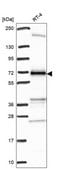 Anti-C17Orf80 Antibody Produced In Rabbit Prestige Antibodies&#174; Powered by Atlas Antibodies, affinity isolated antibody, buffered aqueous glycerol solution