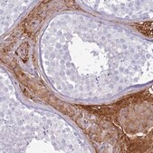Anti-TPPP3 antibody produced in rabbit Prestige Antibodies&#174; Powered by Atlas Antibodies, affinity isolated antibody, buffered aqueous glycerol solution