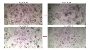 3dGRO® Human Liver Organoids MNFBQ01LI(66-68) Normal, Liver, Age: 65, Female, Mutation: None