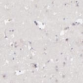 Anti-F13B antibody produced in rabbit Prestige Antibodies&#174; Powered by Atlas Antibodies, affinity isolated antibody, buffered aqueous glycerol solution