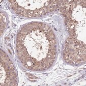 Anti-NPHP1 antibody produced in rabbit Prestige Antibodies&#174; Powered by Atlas Antibodies, affinity isolated antibody, buffered aqueous glycerol solution