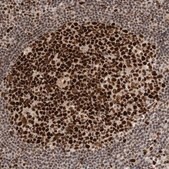 Anti-CHAF1B antibody produced in rabbit Prestige Antibodies&#174; Powered by Atlas Antibodies, affinity isolated antibody, buffered aqueous glycerol solution