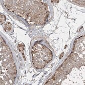 Anti-GRSF1 antibody produced in rabbit Prestige Antibodies&#174; Powered by Atlas Antibodies, affinity isolated antibody, buffered aqueous glycerol solution
