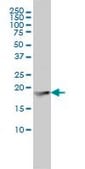 Monoclonal Anti-FTL antibody produced in mouse clone X3, purified immunoglobulin, buffered aqueous solution