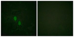 Anti-HNRPD antibody produced in rabbit affinity isolated antibody