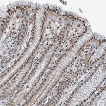 Anti-PHIP antibody produced in rabbit Prestige Antibodies&#174; Powered by Atlas Antibodies, affinity isolated antibody, buffered aqueous glycerol solution